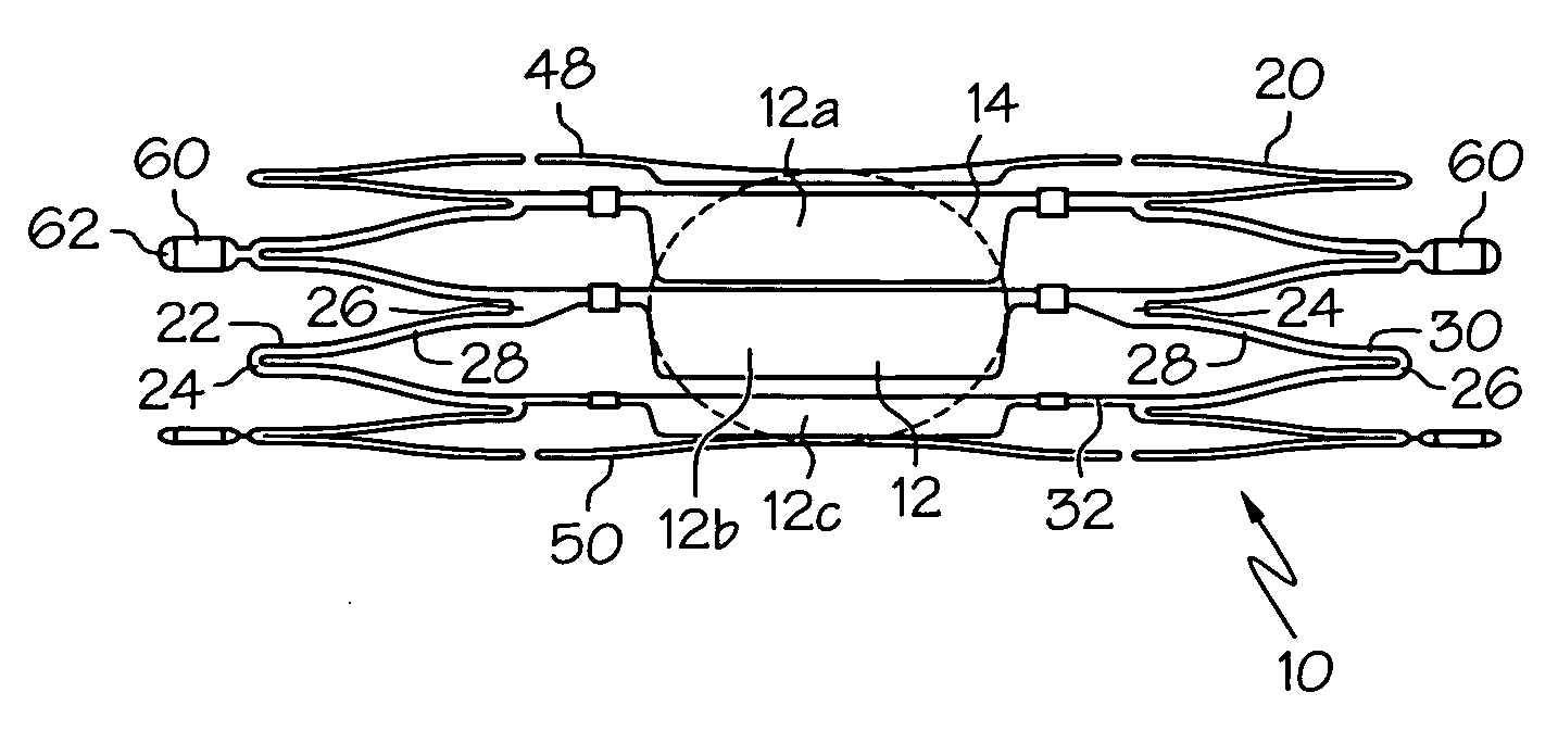 Flap-cover aneurysm stent