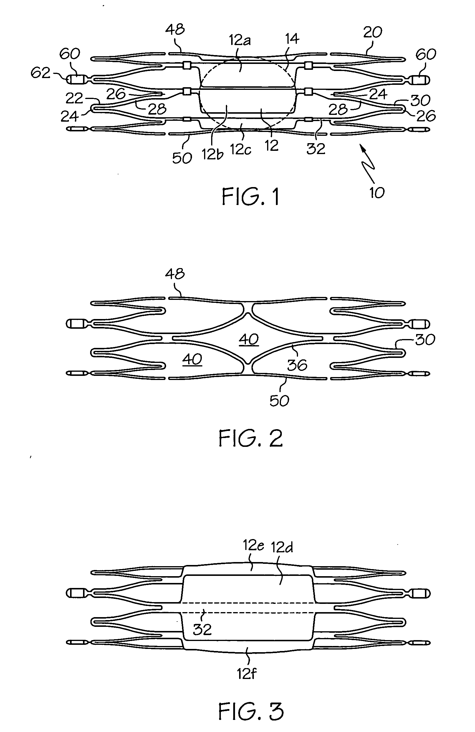 Flap-cover aneurysm stent