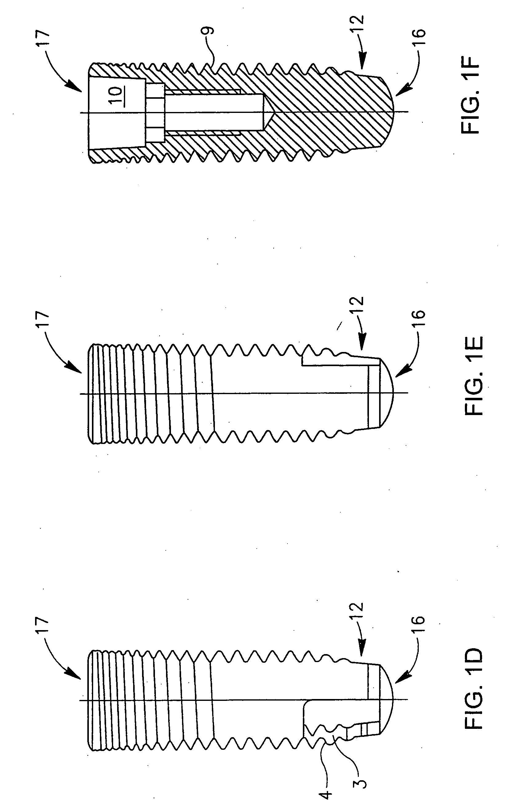 Orthodpedic or dental device