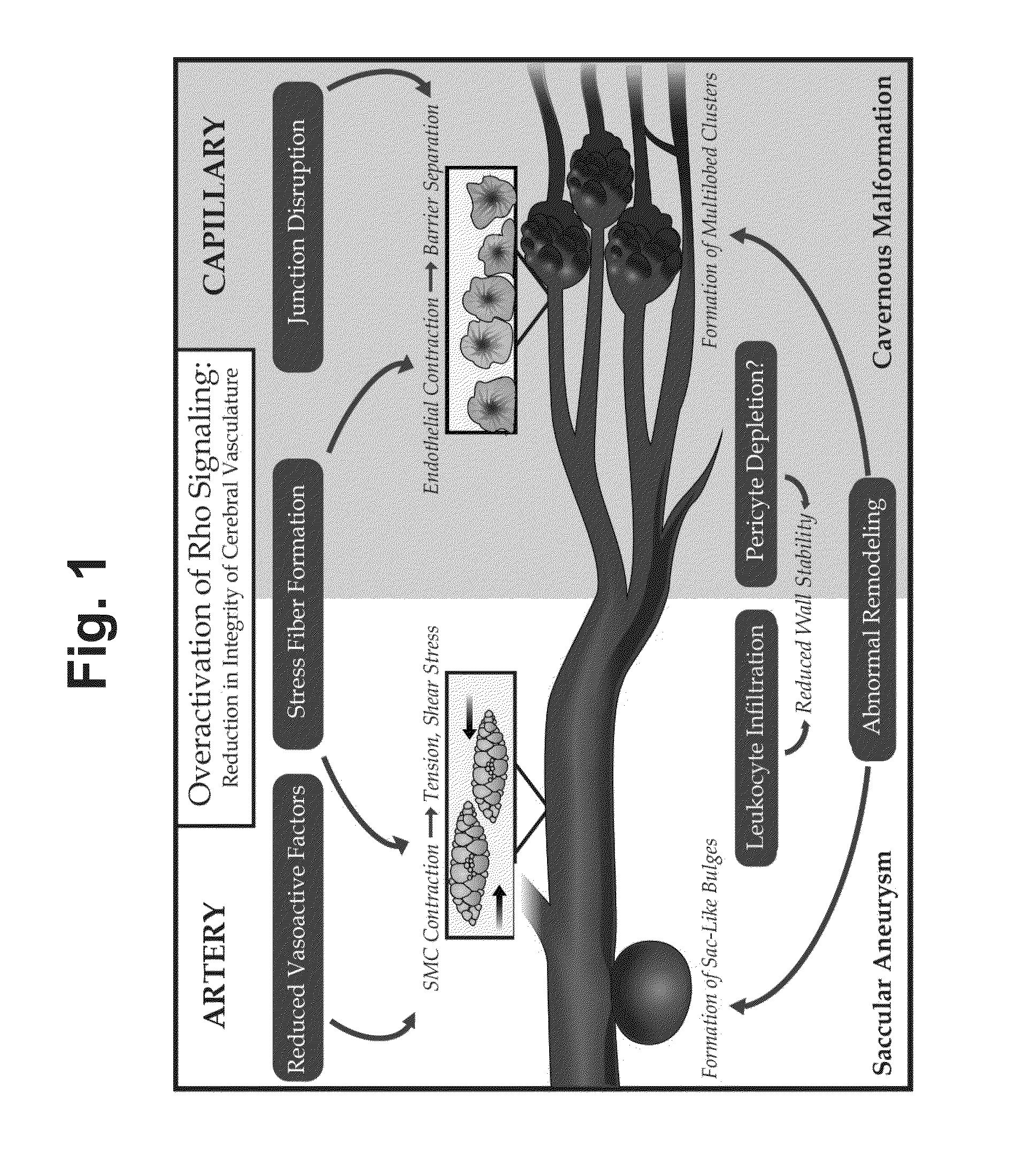 Treatment of cerebral cavernous malformations and cerebral aneurysms with rho kinase inhibitors