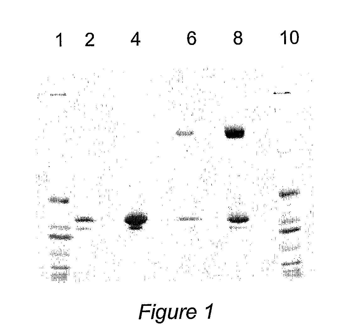 Method to Reduce Oxalate Concentration by Administration of Oxalate Oxidase Crystals