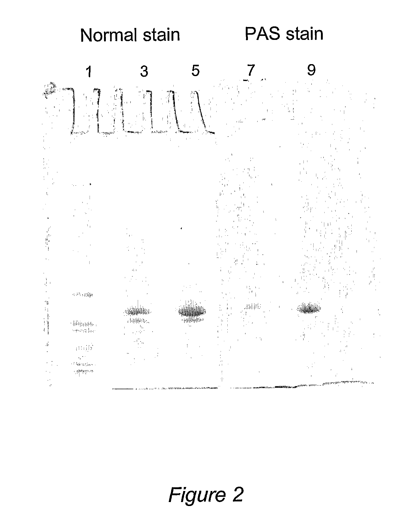 Method to Reduce Oxalate Concentration by Administration of Oxalate Oxidase Crystals