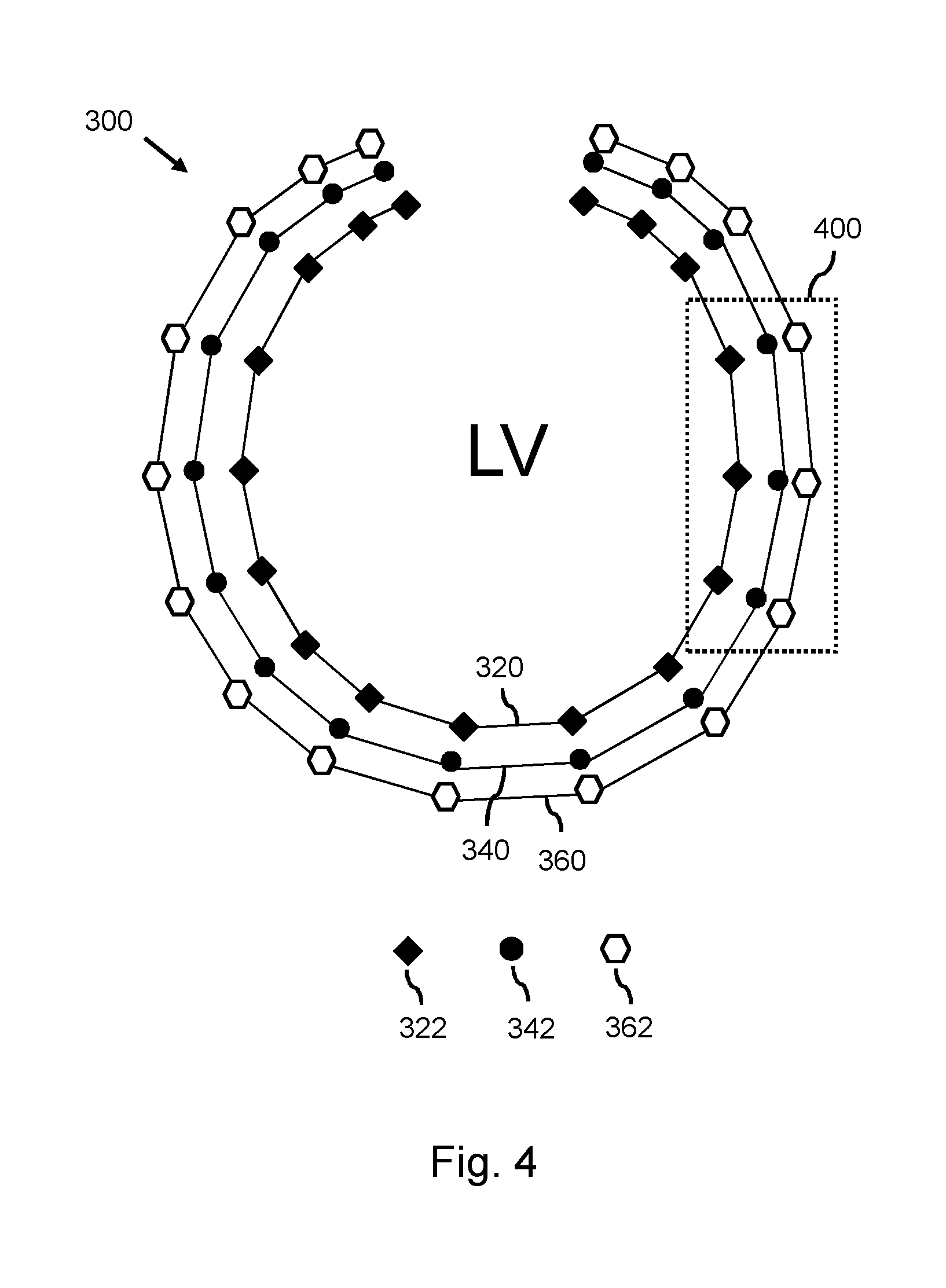 Model-based segmentation of an anatomical structure