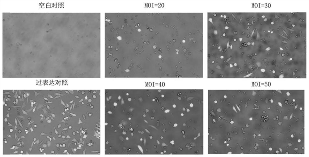 Exosome containing miR-204 and preparation method and application of exosome