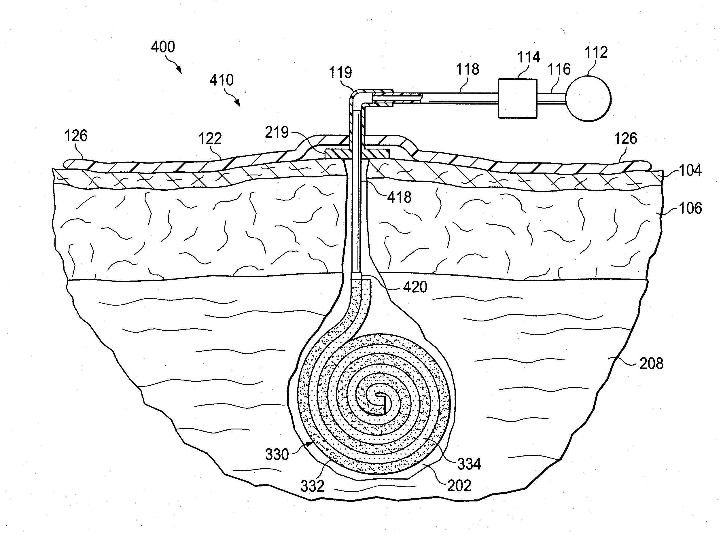 Tissue roll scaffolds