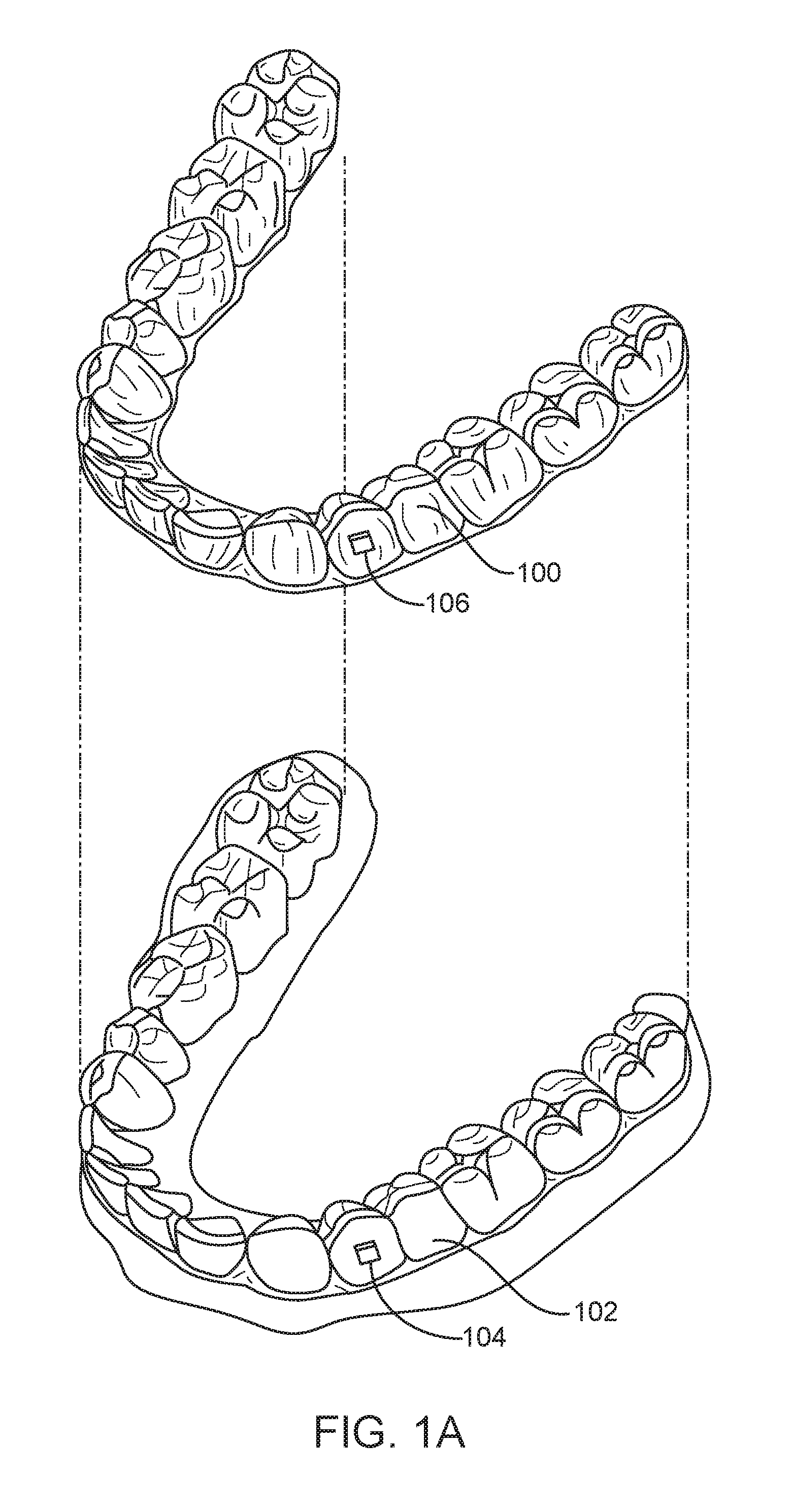 Direct fabrication of aligners for arch expansion