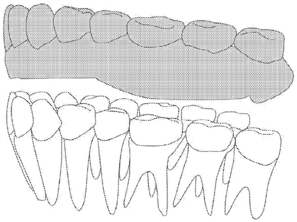 Elastic orthodontic appliance