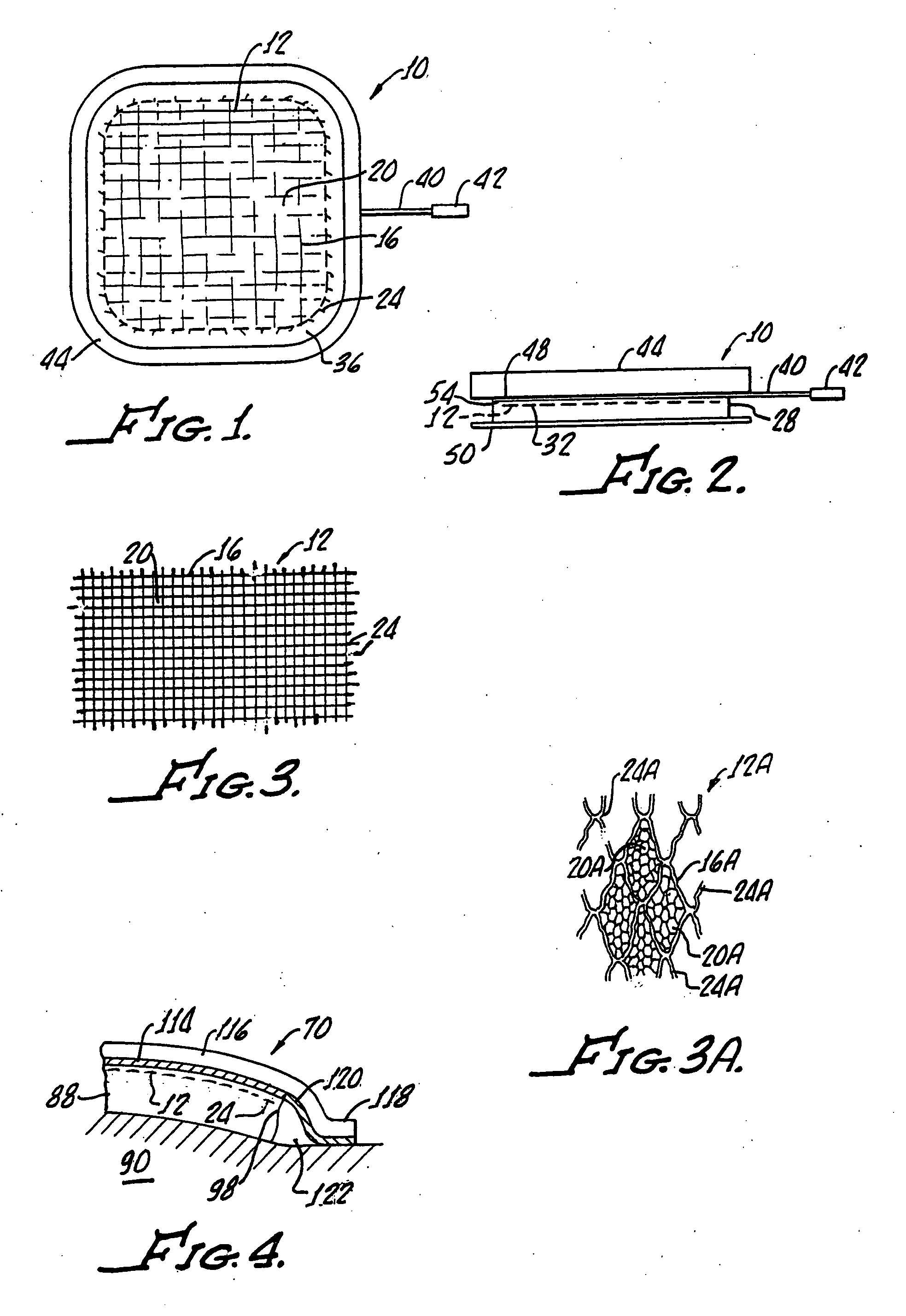 Differential diameter electrode