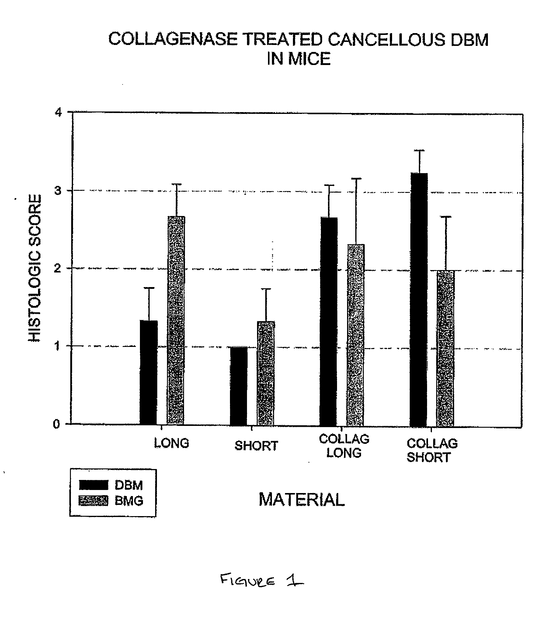 Osteoinductive demineralized cancellous bone