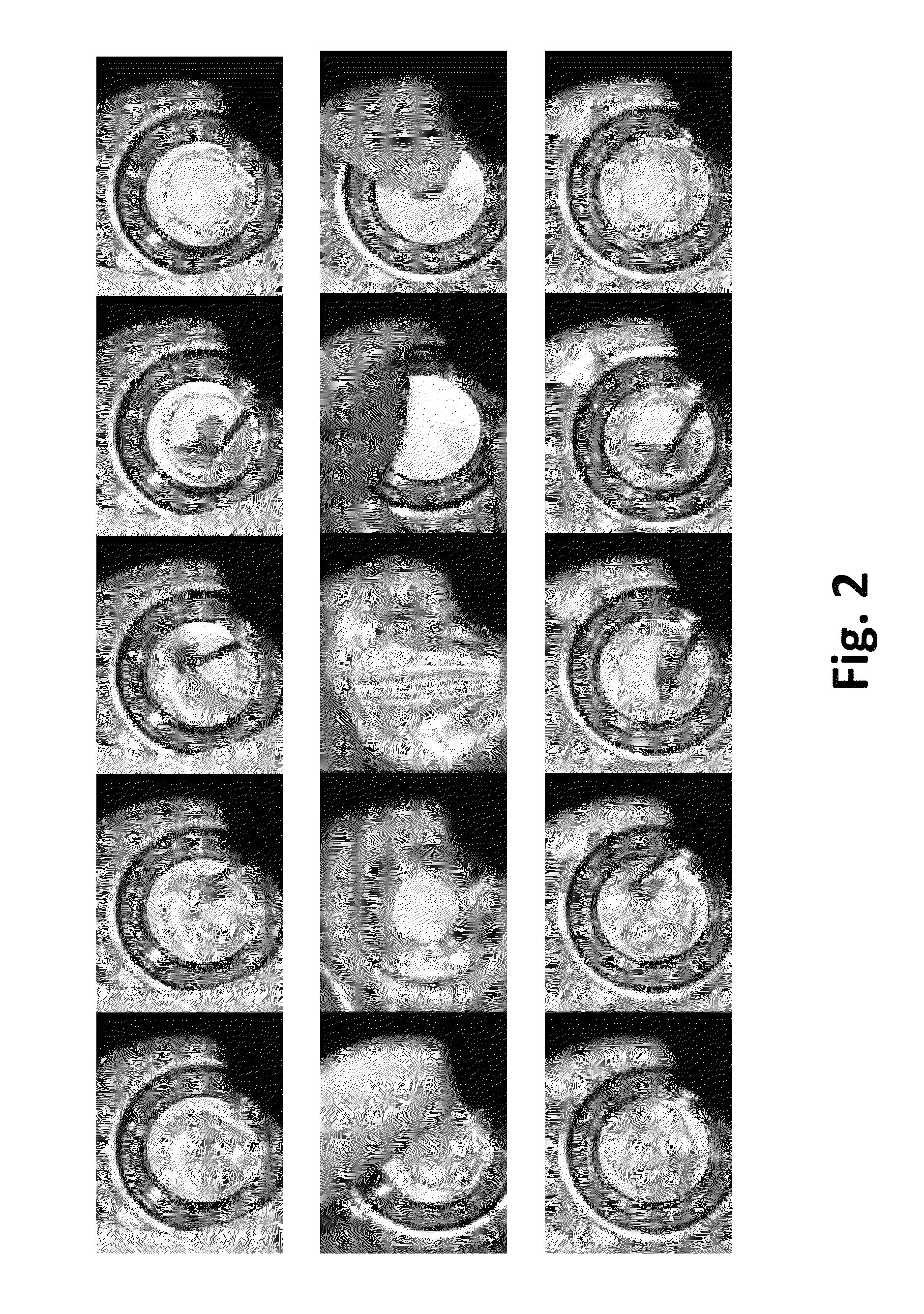 Computer vision based method and system for evaluating and grading surgical procedures