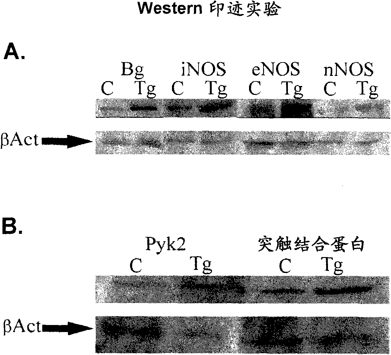 Use of biglycan or enhancers of biglycan activity in the preparation of pharmaceutical compositions