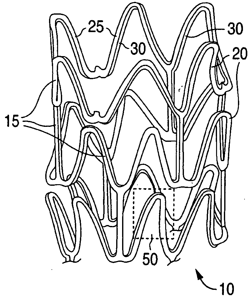 Anti-Proliferative and Anti-Inflammatory Agent Combination for Treatment of Vascular Disorders with an Implantable Medical Device