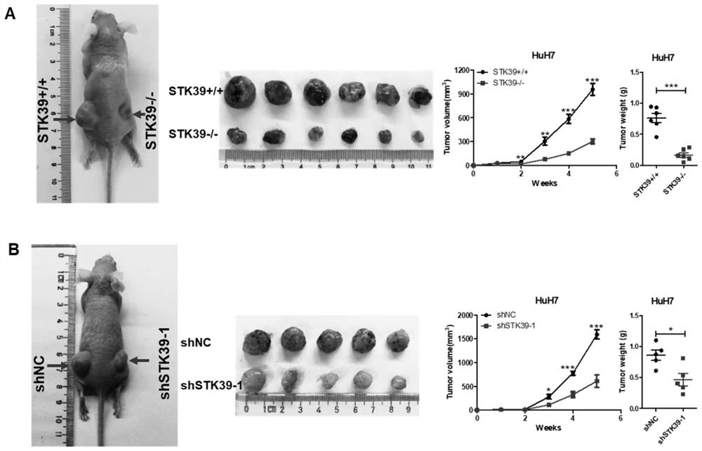 Application of liver cancer diagnosis and treatment oncogenic kinase marker