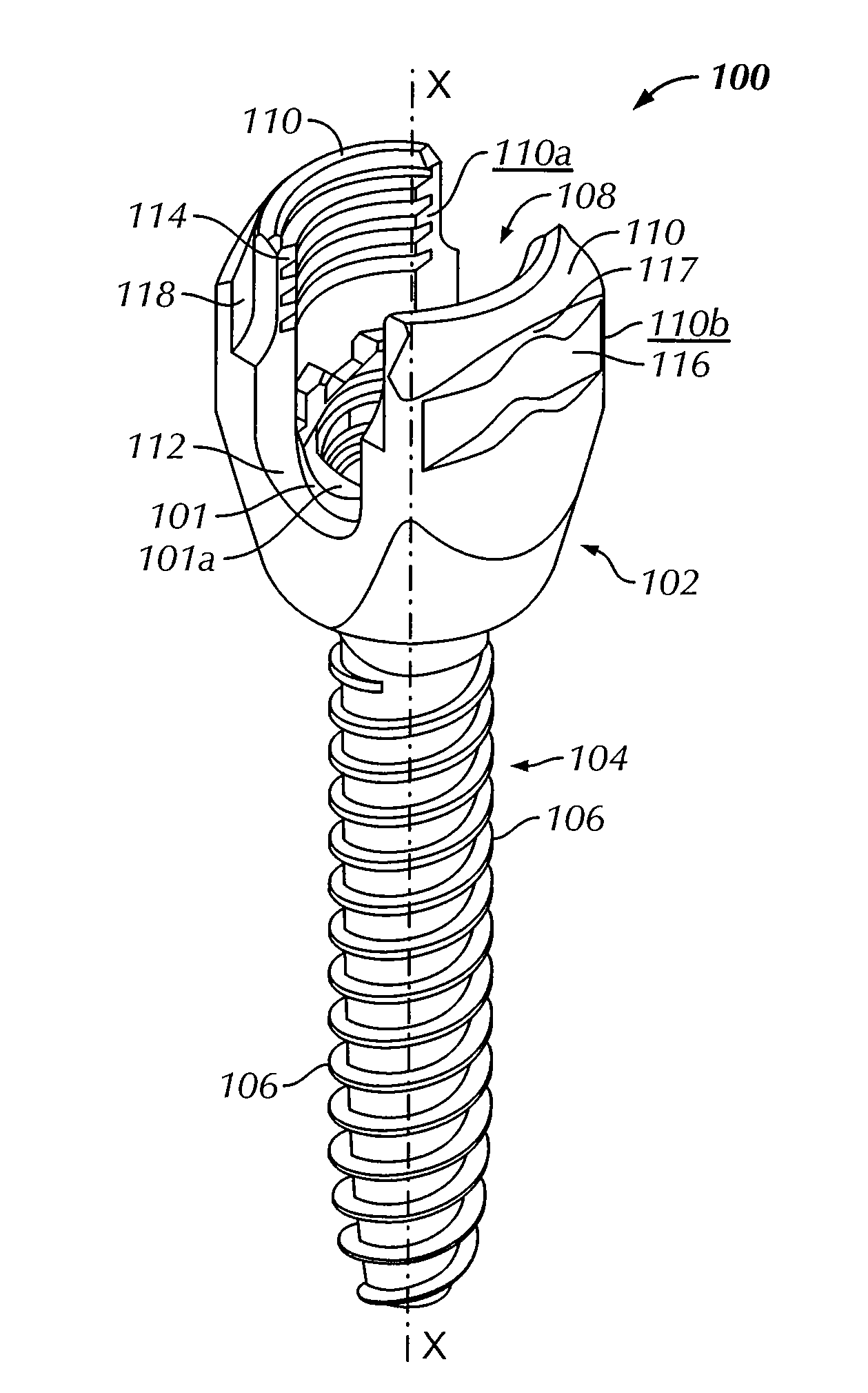 Minimally invasive instrument set, devices and related methods