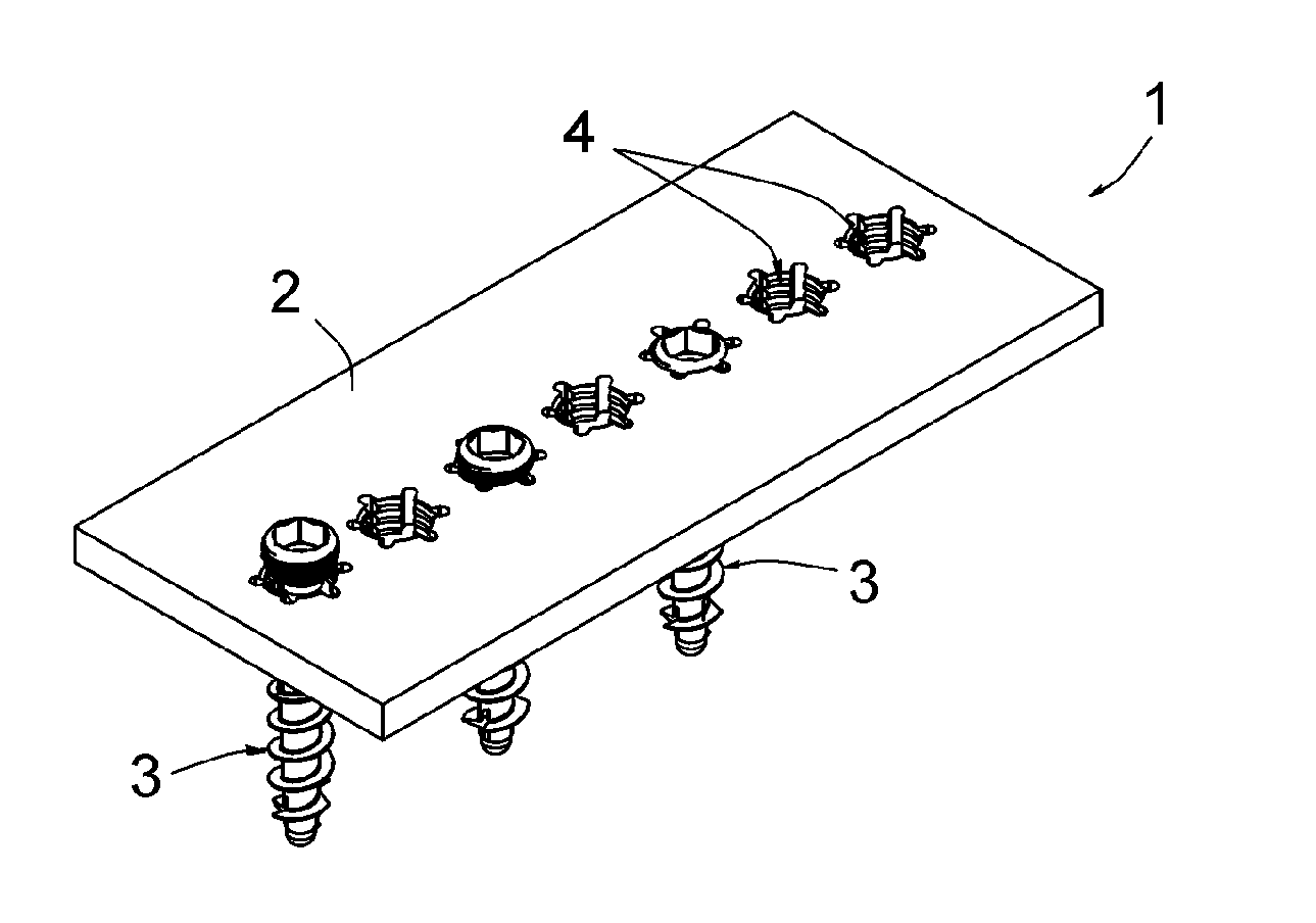 Assembly comprising an implantable part designed to be fastened to one or more bones or bone portions to be joined, and at least one screw for fastening the implantable part to said bone(s)