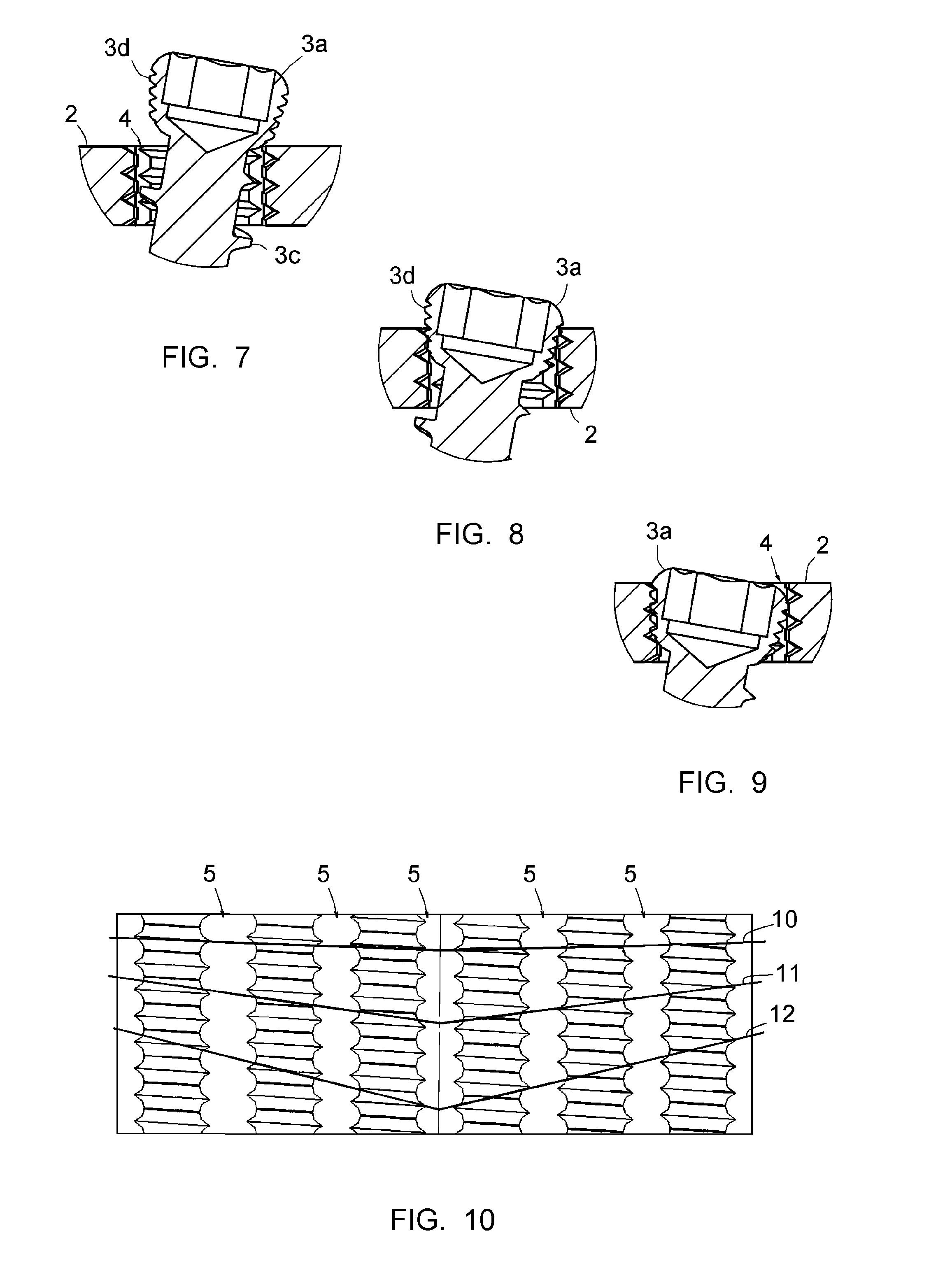 Assembly comprising an implantable part designed to be fastened to one or more bones or bone portions to be joined, and at least one screw for fastening the implantable part to said bone(s)