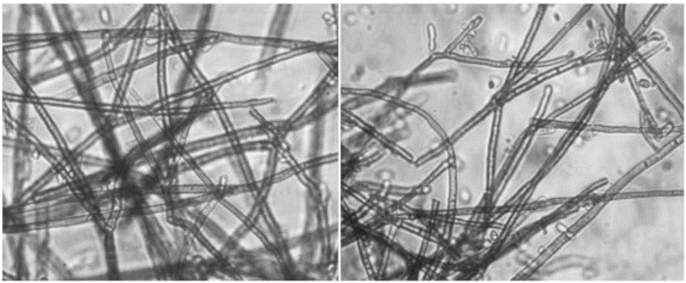 Cc-106 (cladosporium cladosporioides) strain for high-yield production of lovastatin and application thereof