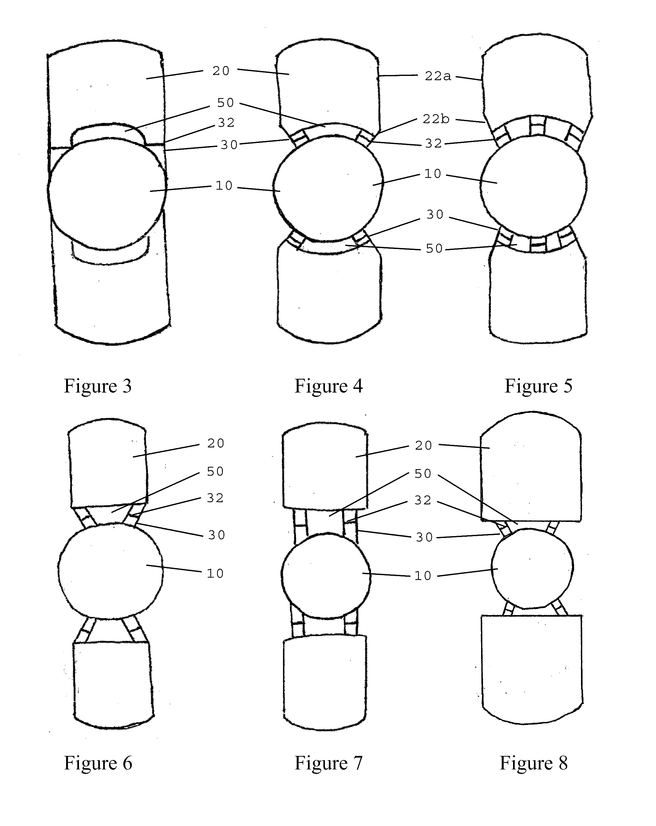 Tilt Stabilizing Accommodating Intraocular Lens