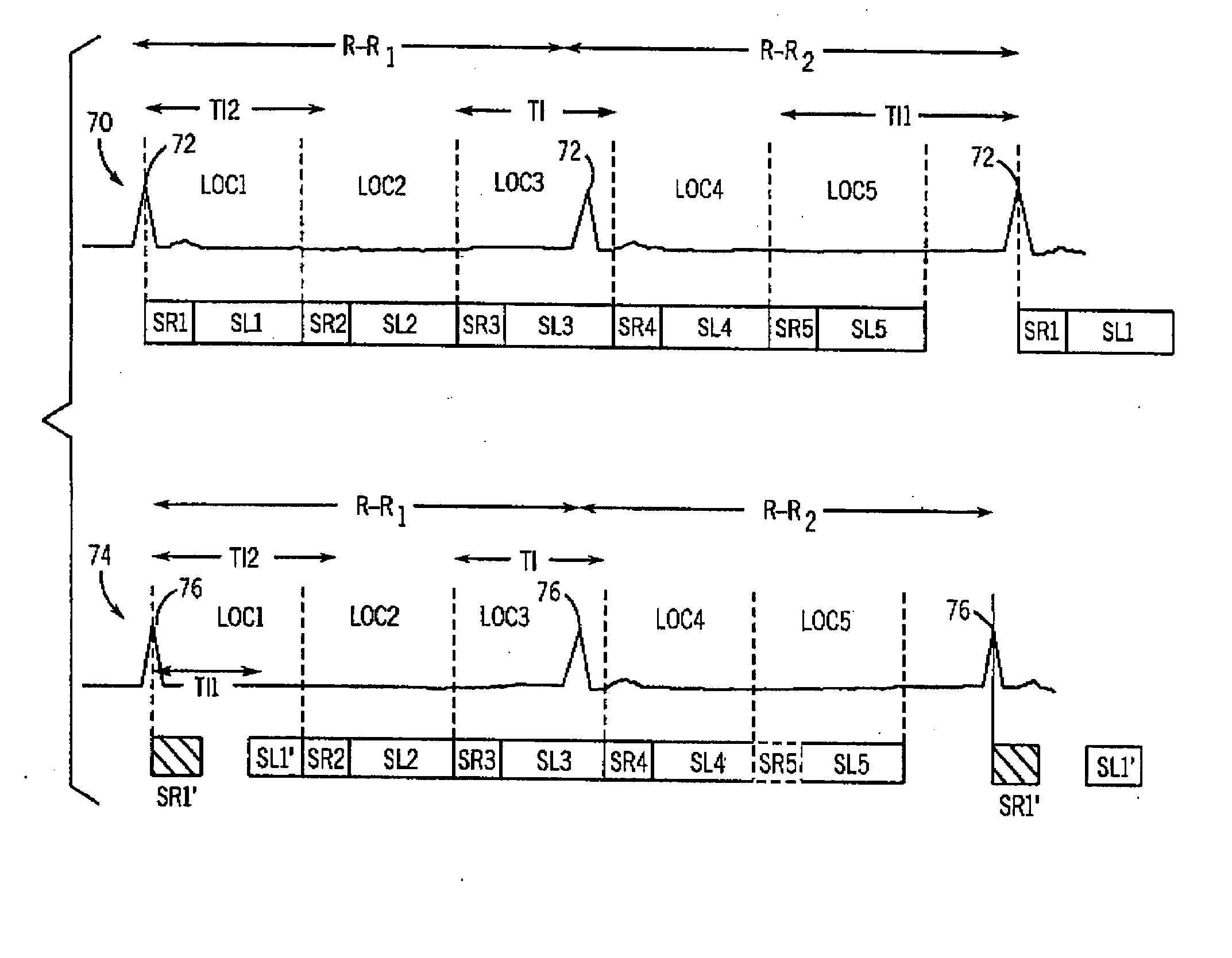 Method and apparatus for mr perfusion image acquisition using non-selective and notched RF saturation pulses