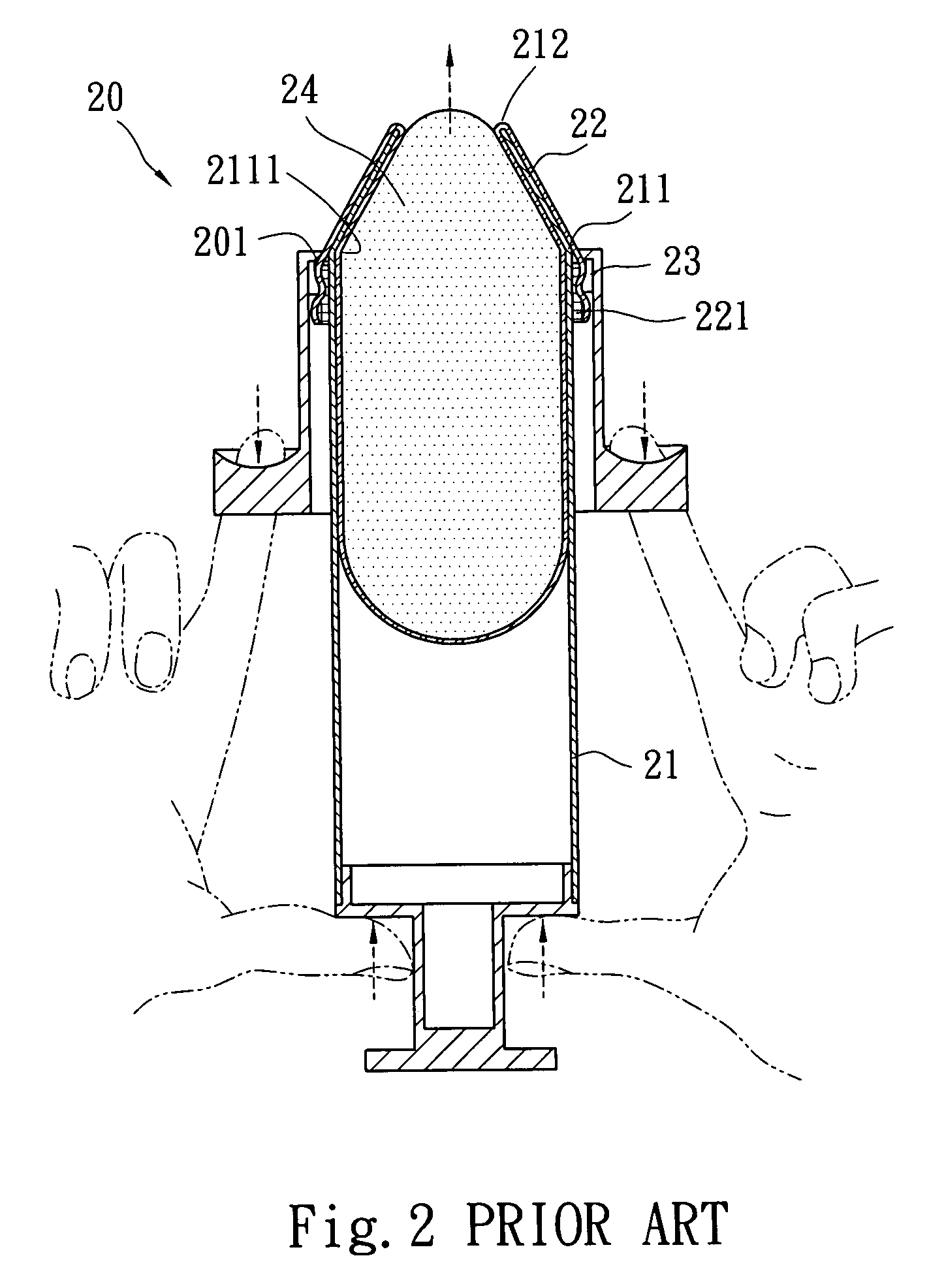 Silicon breast implant injector for augmentation mammaplasty