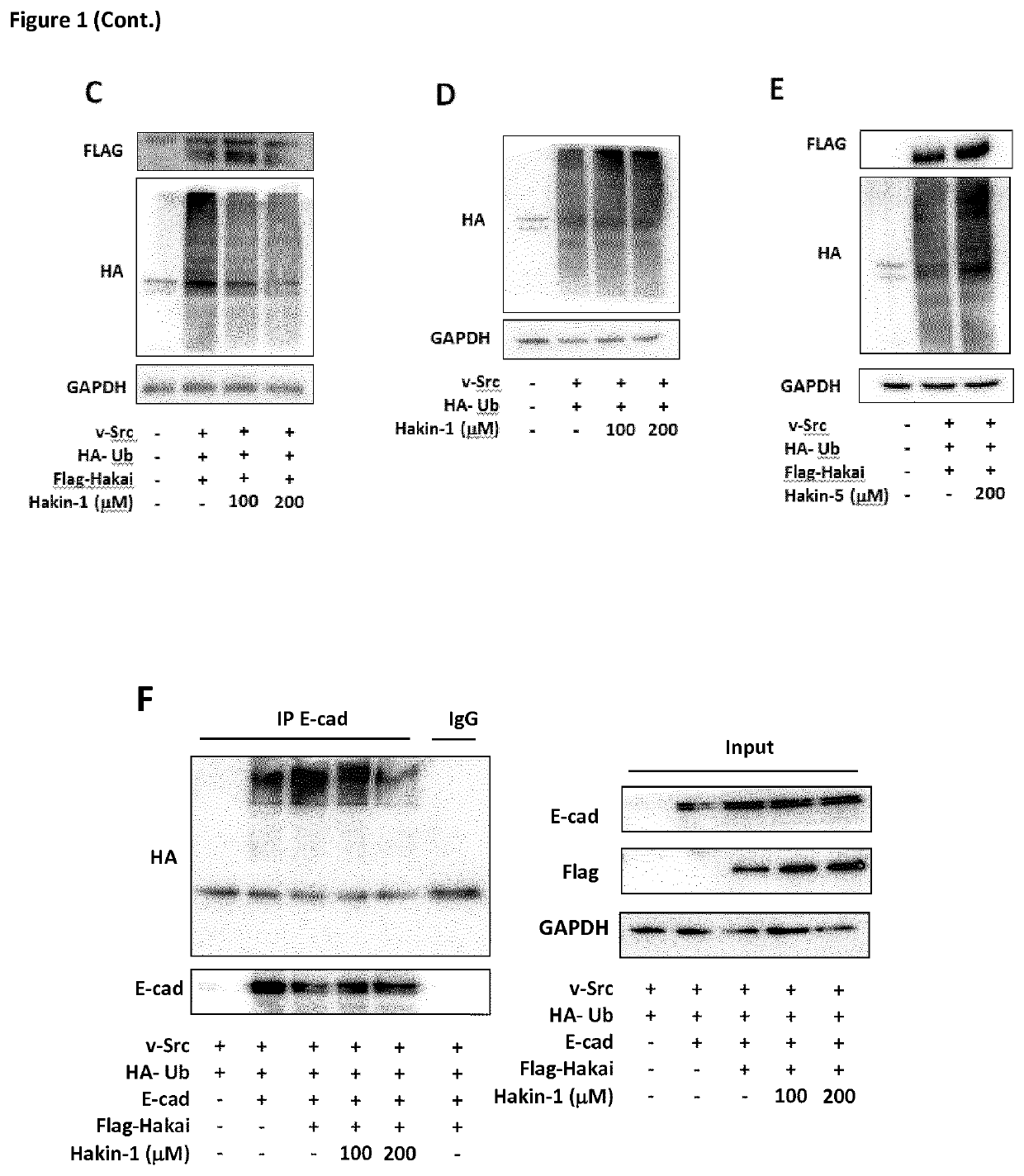 Compounds that selectively and effectively inhibit hakai-mediated ubiquitination, as Anti-cancer drugs