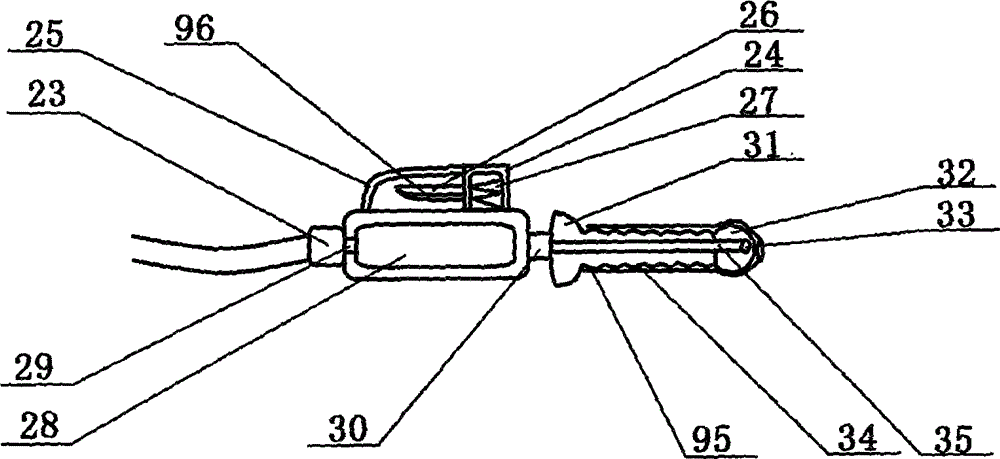 Medical vaginal douching device in gynecology department