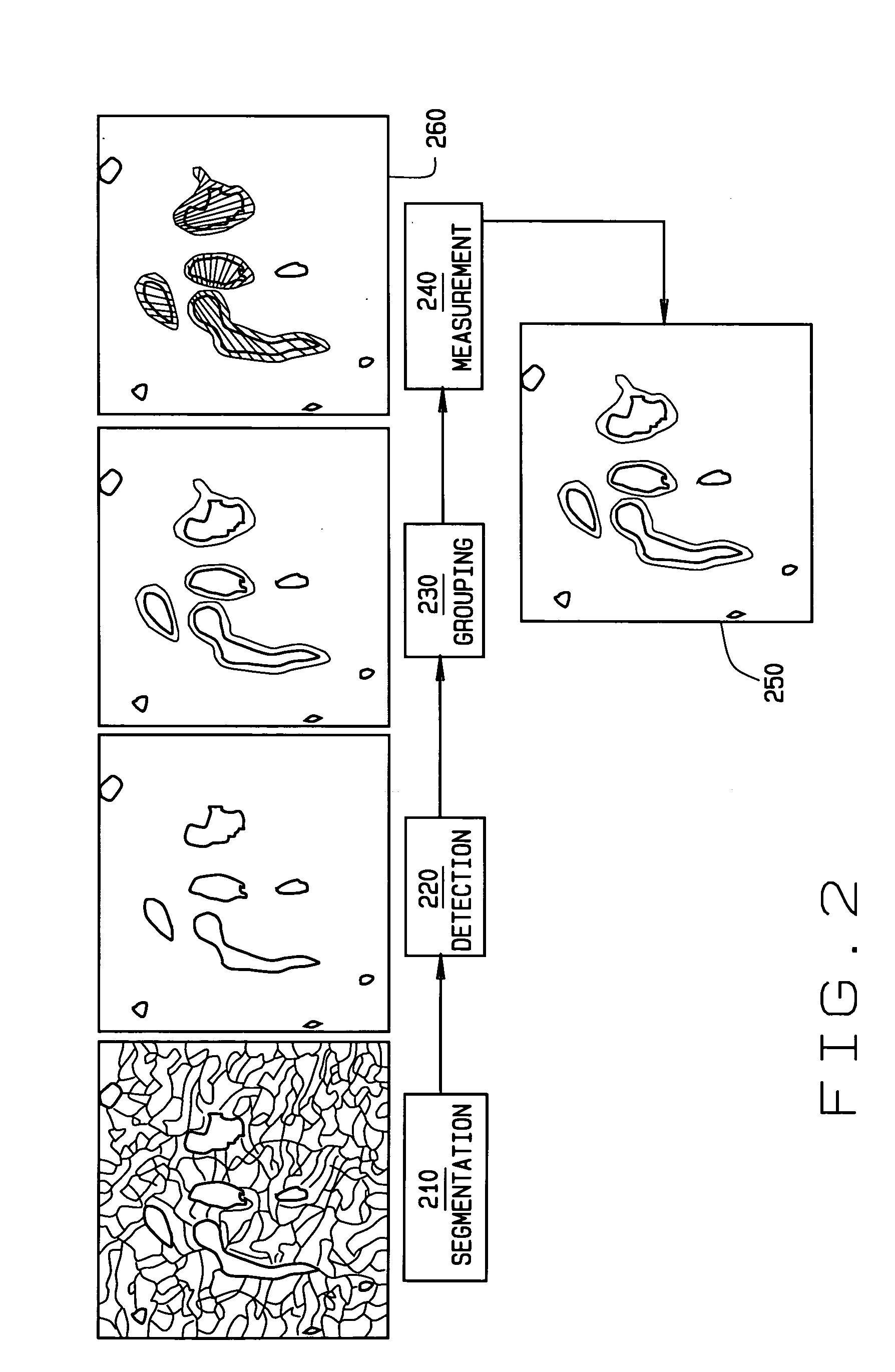 Methods and apparatus for processing image data to aid in detecting disease