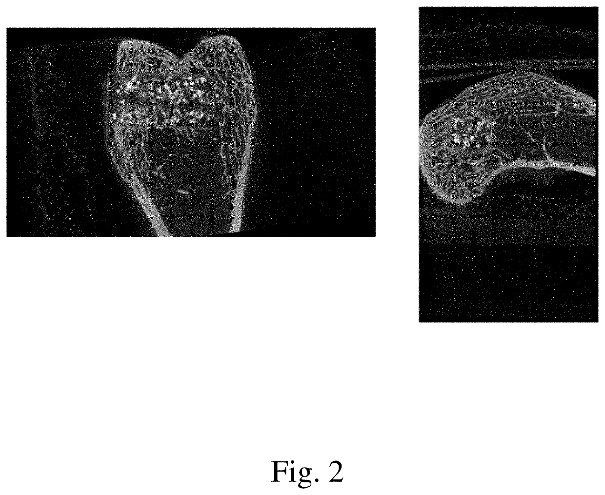 Bone putty for bone pore and void filling