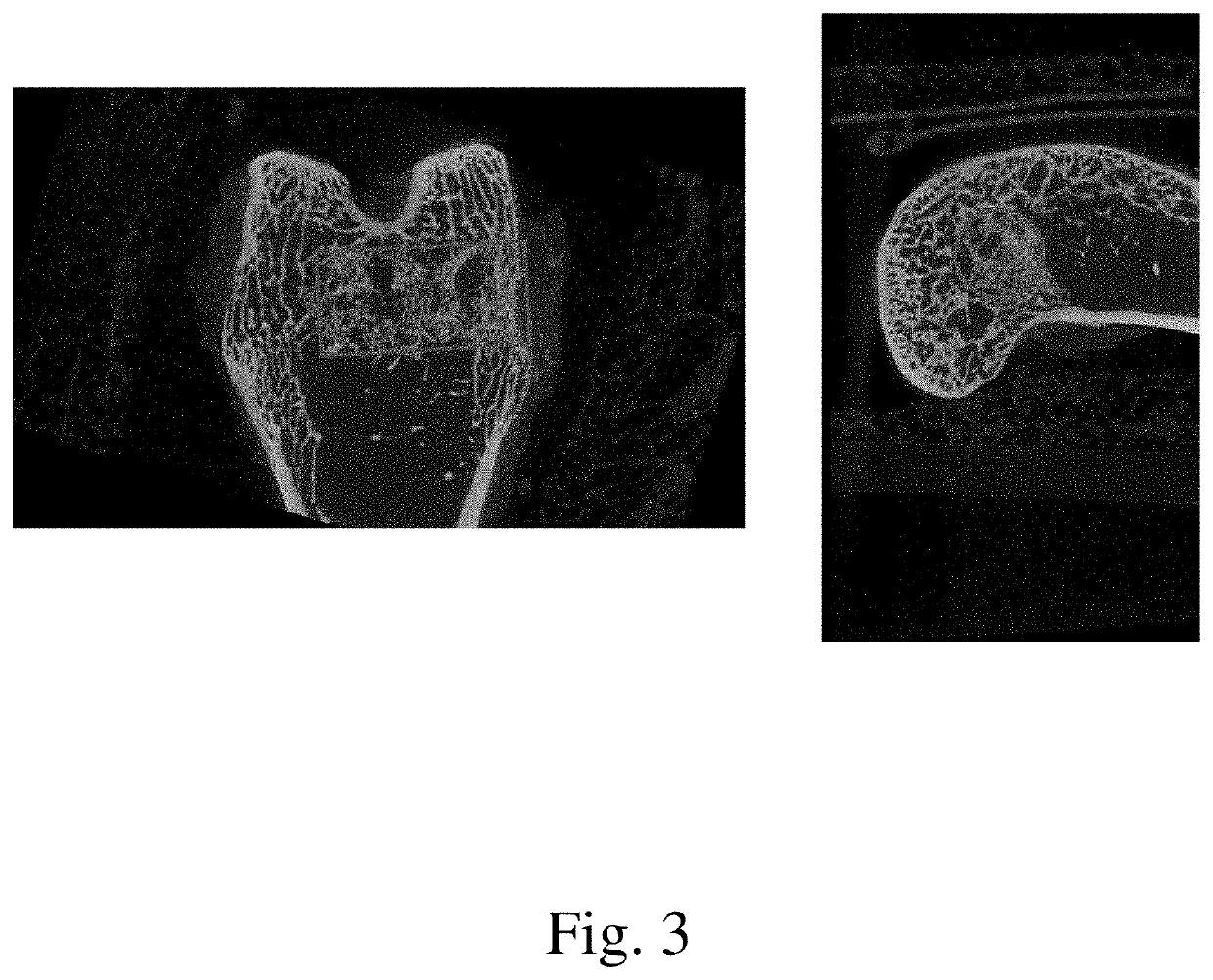 Bone putty for bone pore and void filling