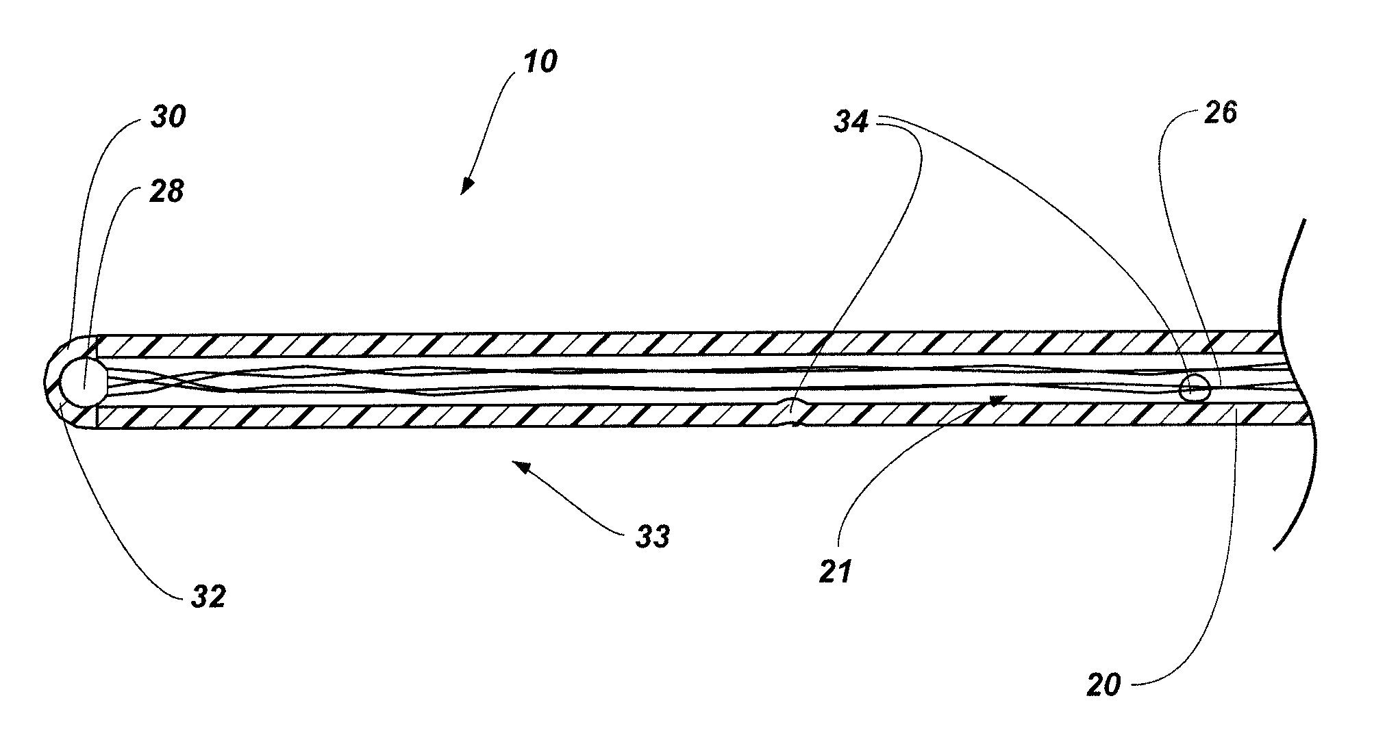 Catheters, catheters for use in ultrasound guided procedures, and related methods