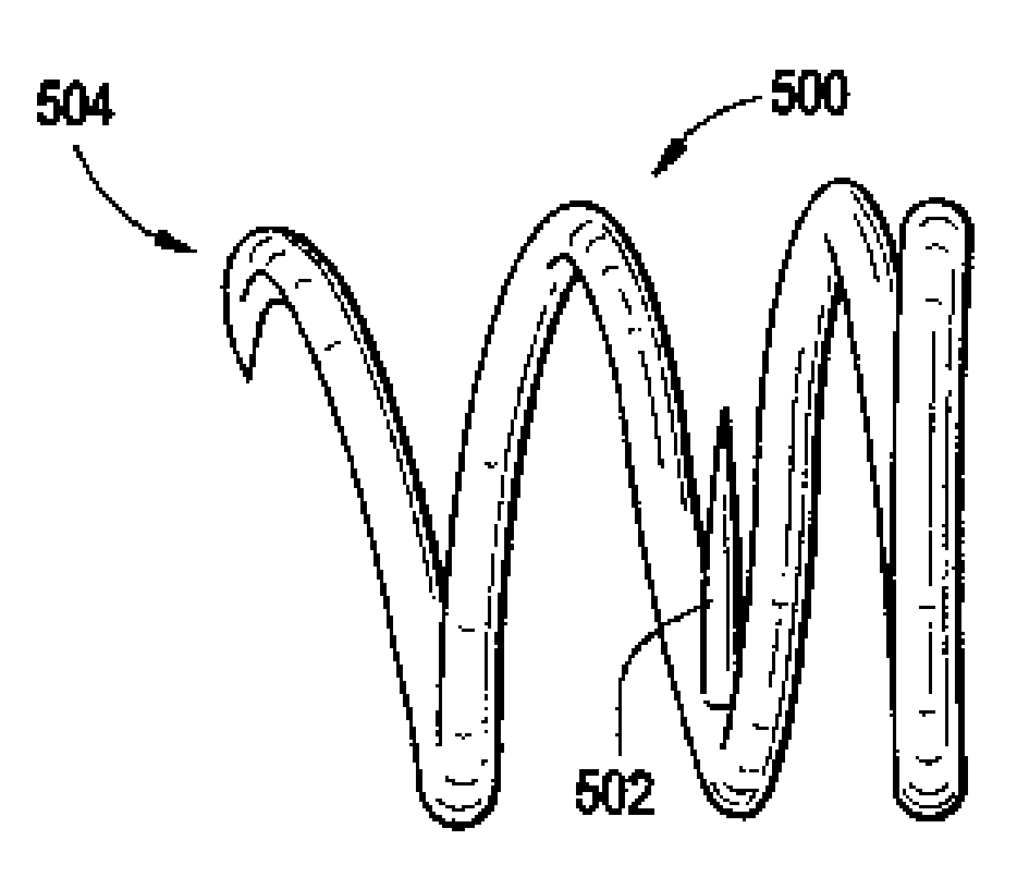 System using a helical retainer in the direct plication annuloplasty treatment of mitral valve regurgitation