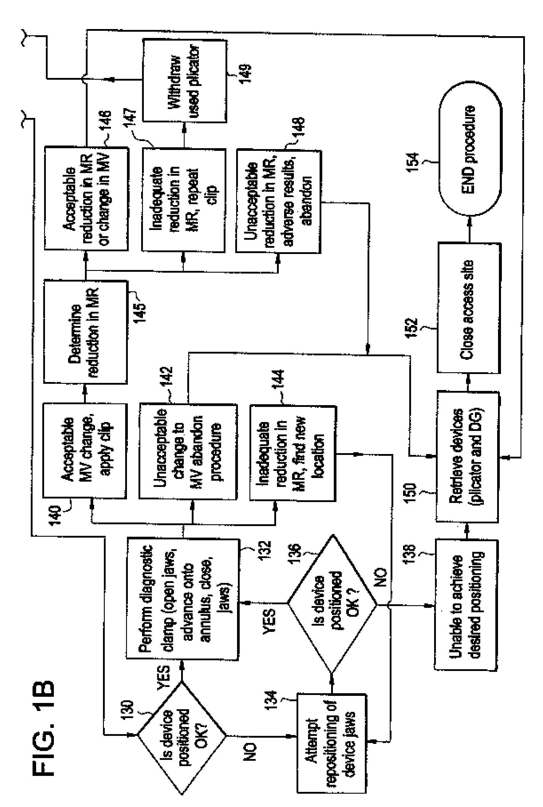 System using a helical retainer in the direct plication annuloplasty treatment of mitral valve regurgitation