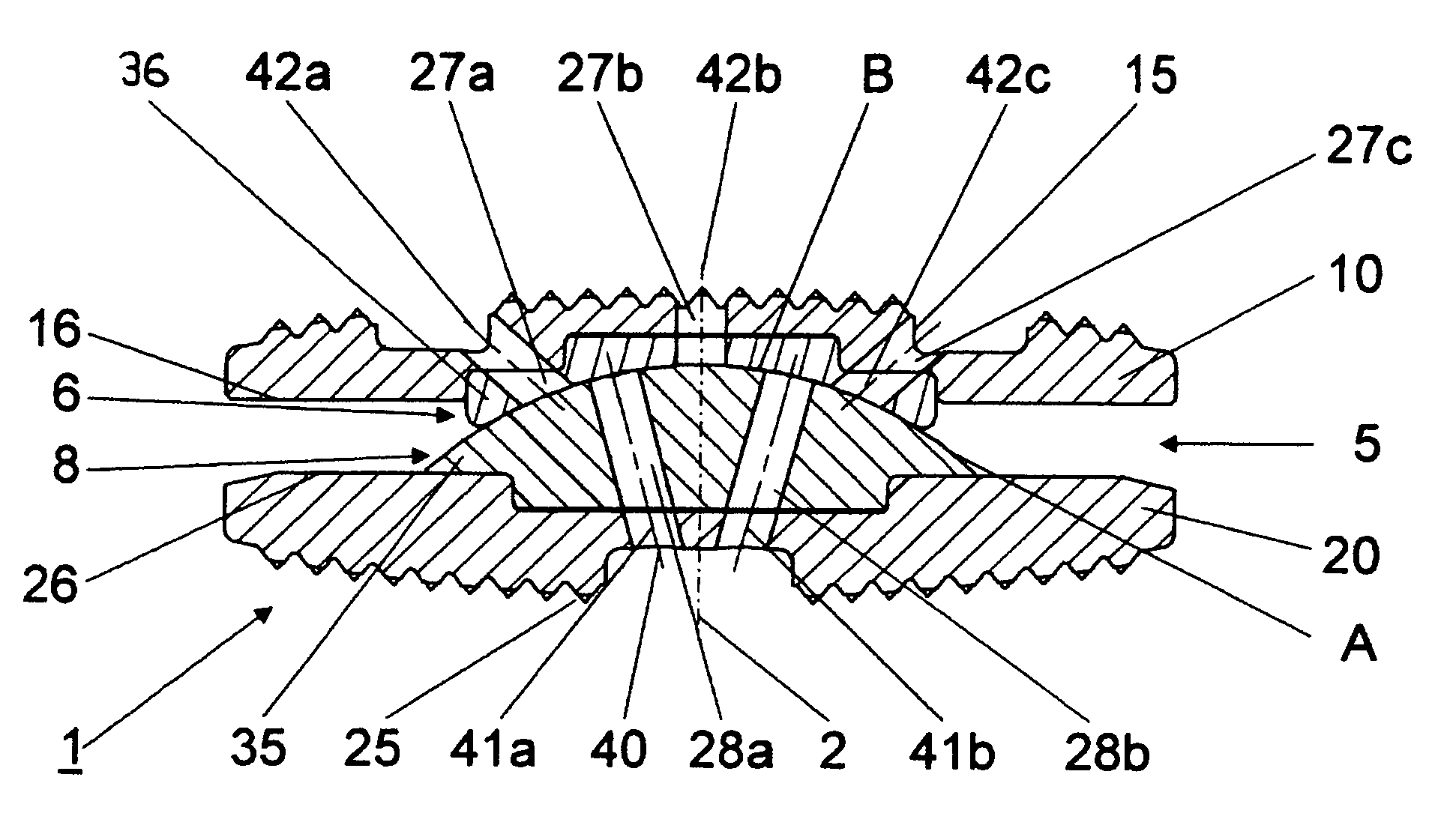 Articulated endoprosthesis