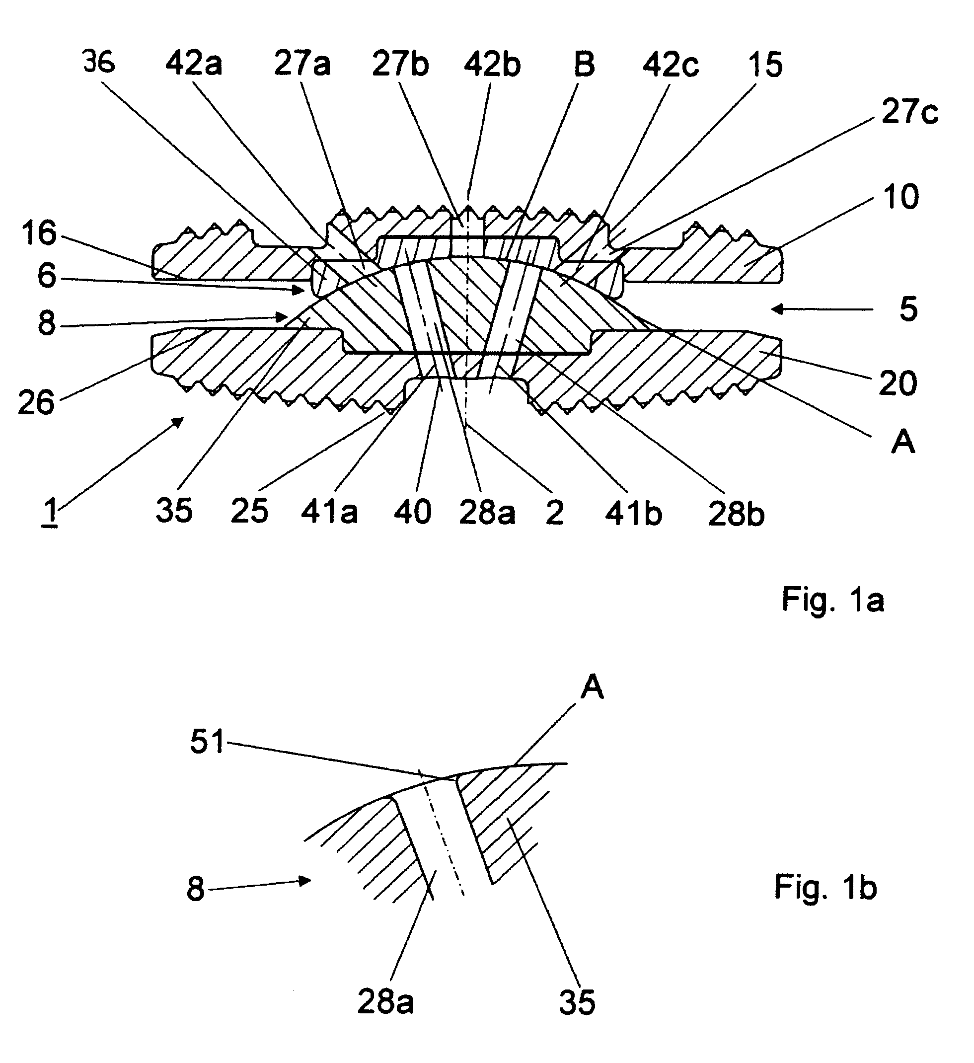 Articulated endoprosthesis