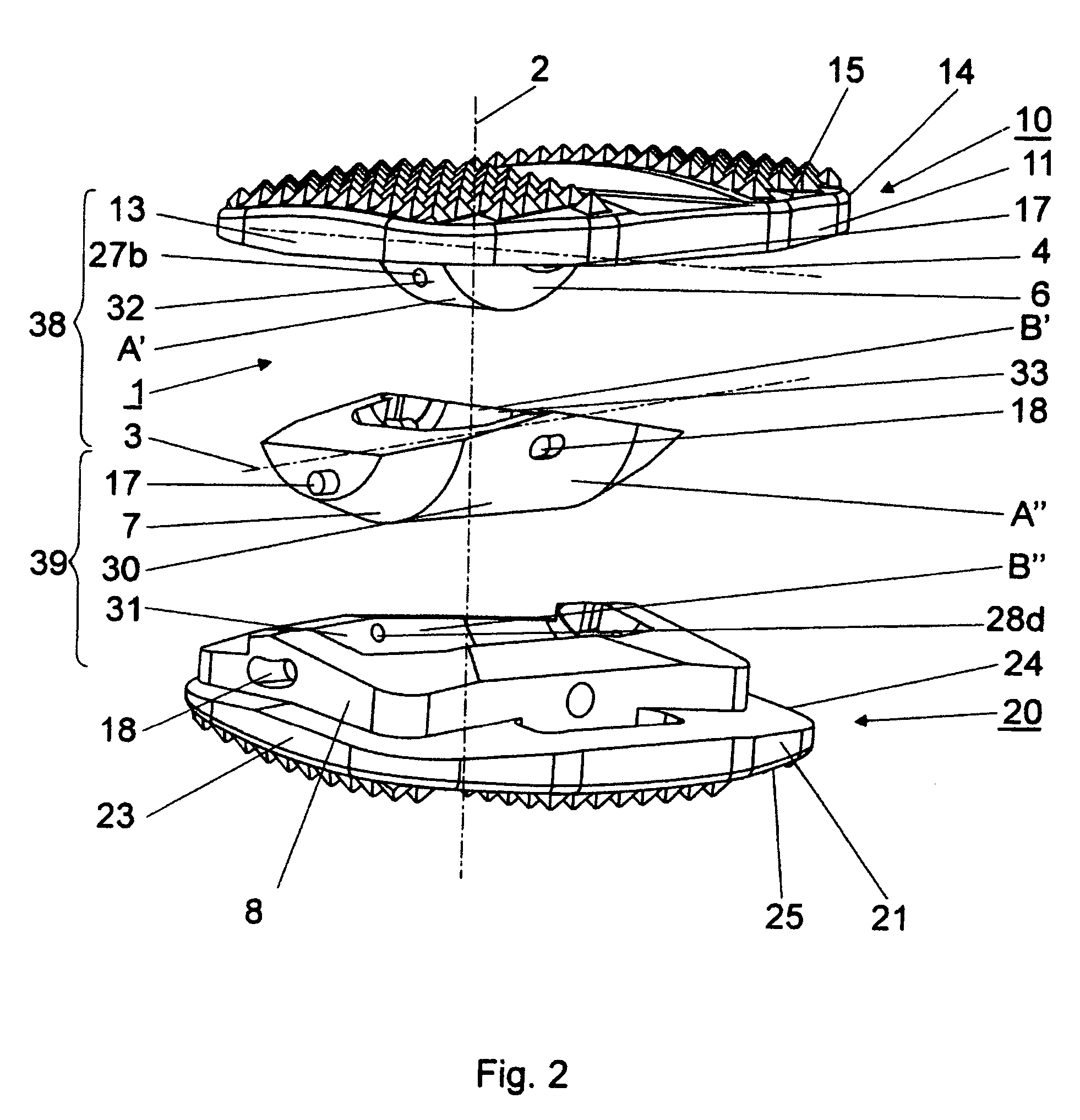 Articulated endoprosthesis