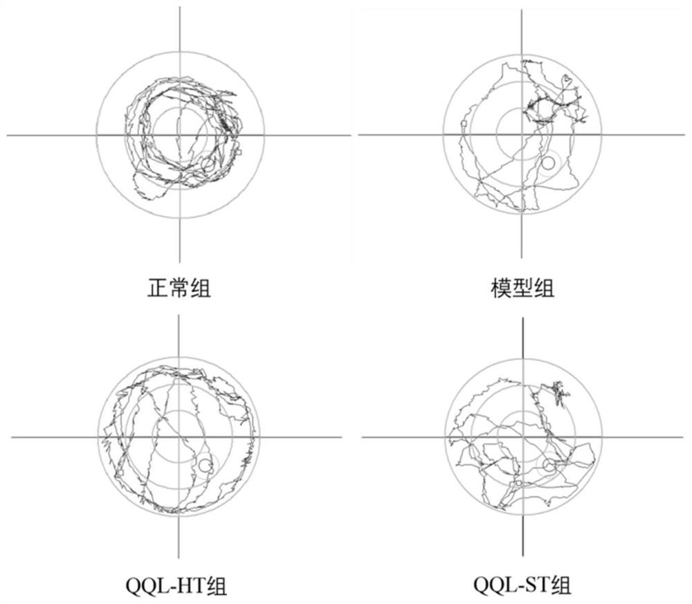 Cyclocarya paliurus extract and application thereof