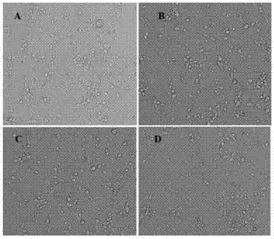 Cell model for diabetes complicated with depression, and establishing method and application thereof