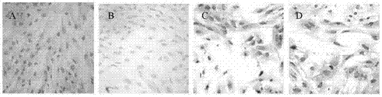 Cell model for diabetes complicated with depression, and establishing method and application thereof