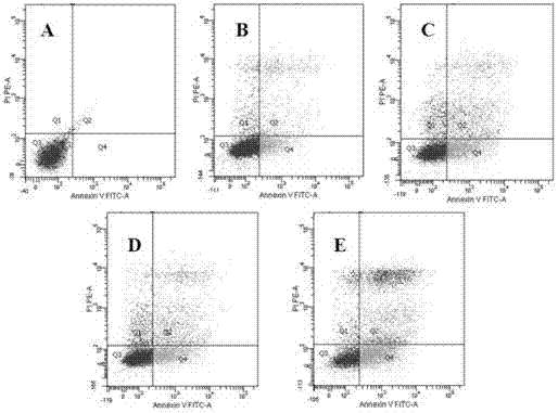 Cell model for diabetes complicated with depression, and establishing method and application thereof