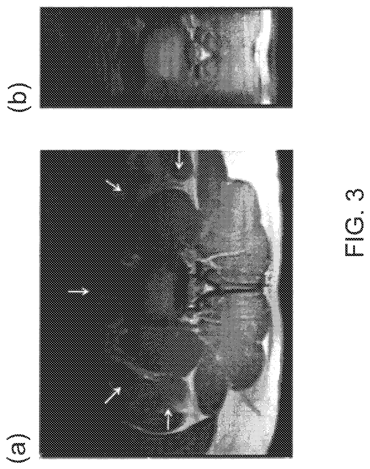 Imaging biomarkers for the diagnosis and prognosis of back pain and related conditions