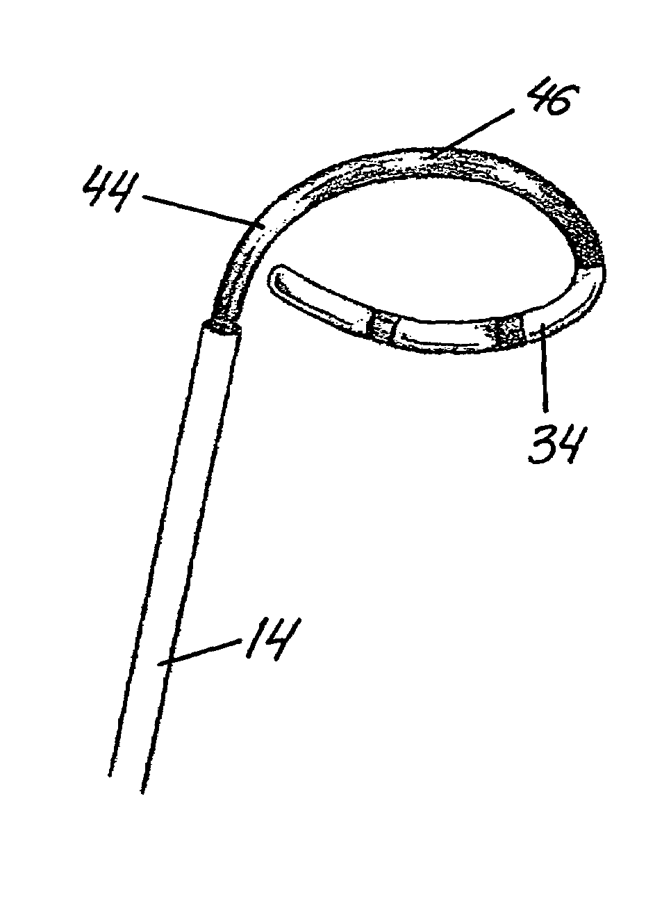 Catheter apparatus for treatment of heart arrhythmia