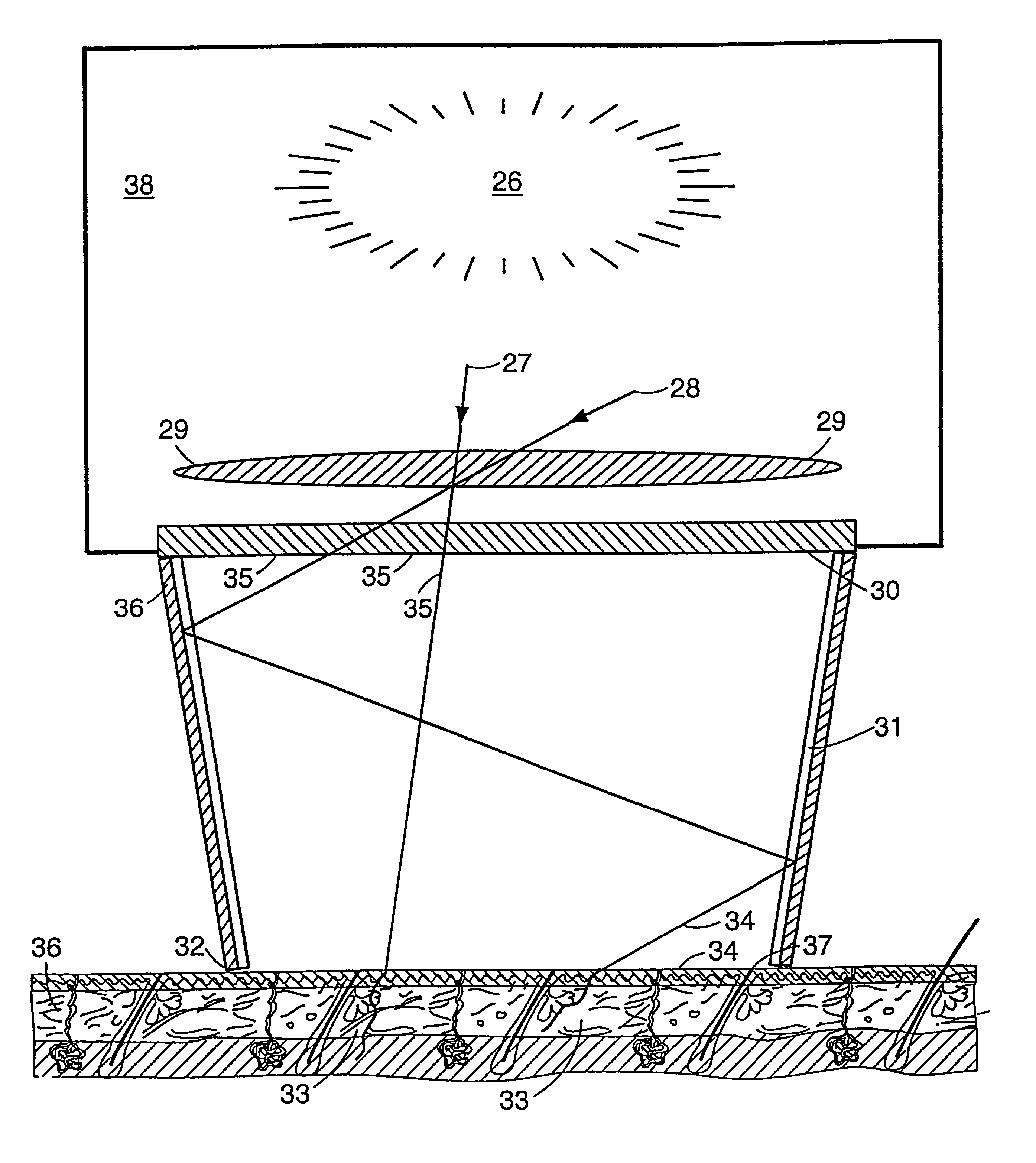 Multiple pulse photo-dermatological device