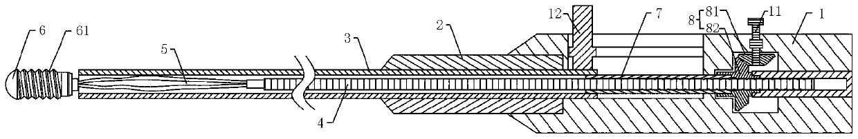 Stone removal basket with threaded guide head