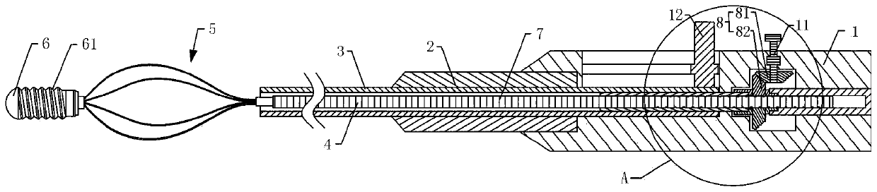 Stone removal basket with threaded guide head