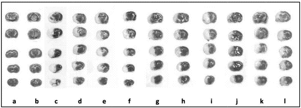 Excitotoxicity related injury treatment method