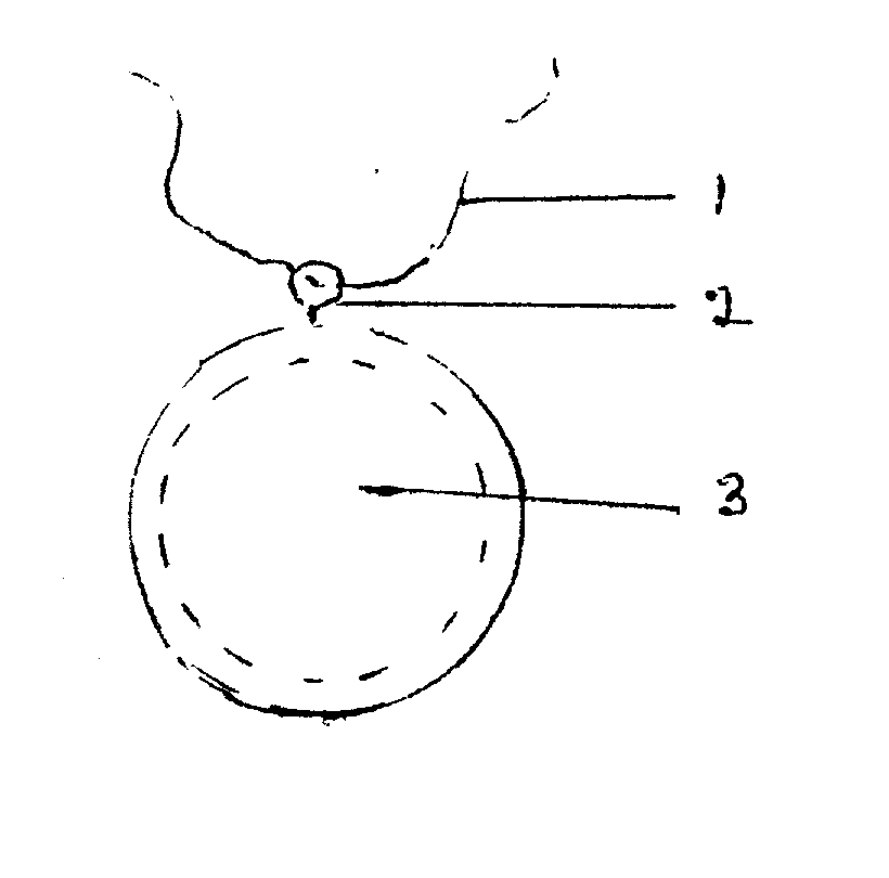 Proprioceptive device that contains nutrients for the treatment of stratural diseases