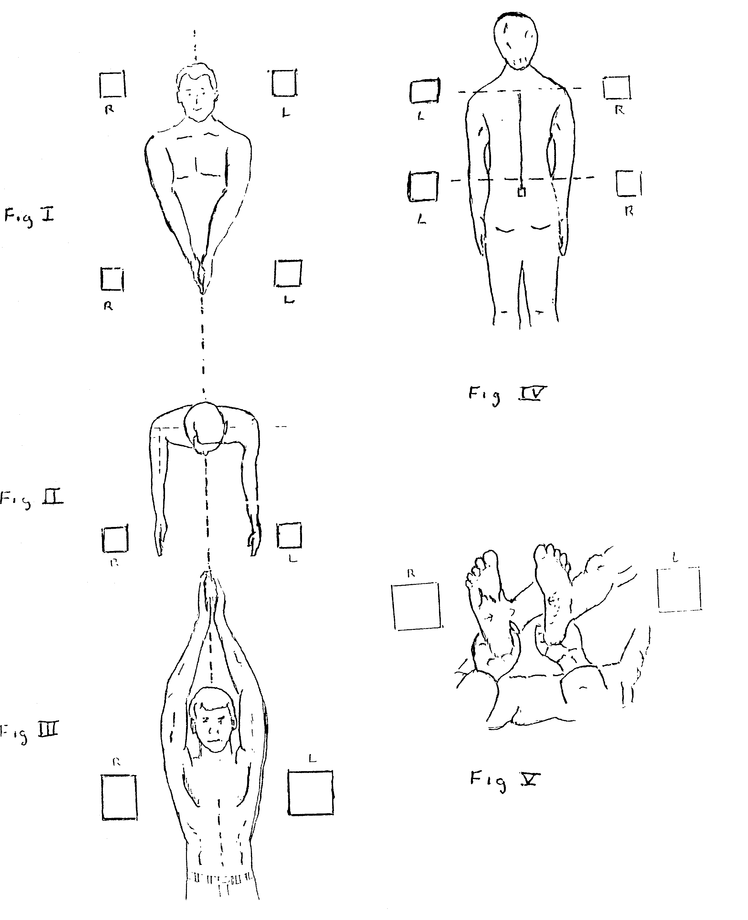 Proprioceptive device that contains nutrients for the treatment of stratural diseases