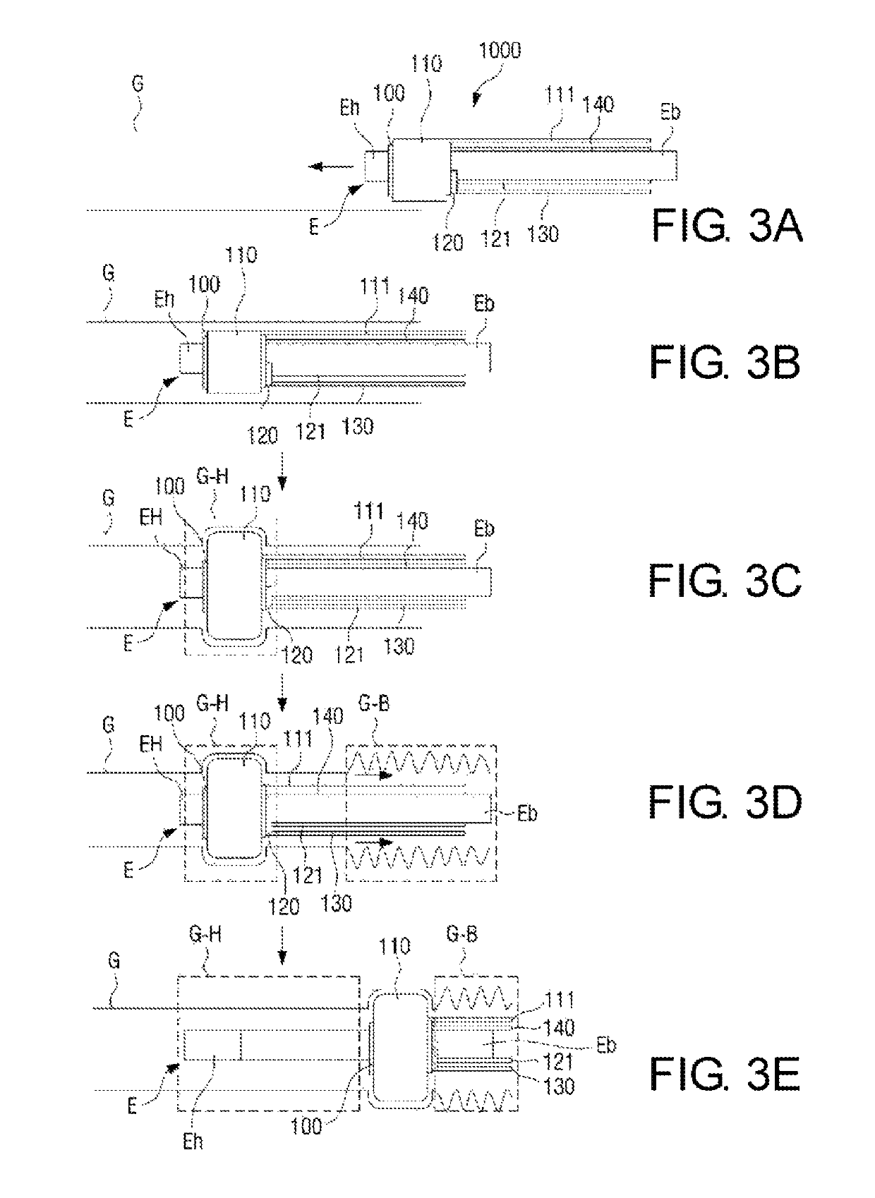 Apparatus and method for fixing and shortening bowel at the time of endoscopy