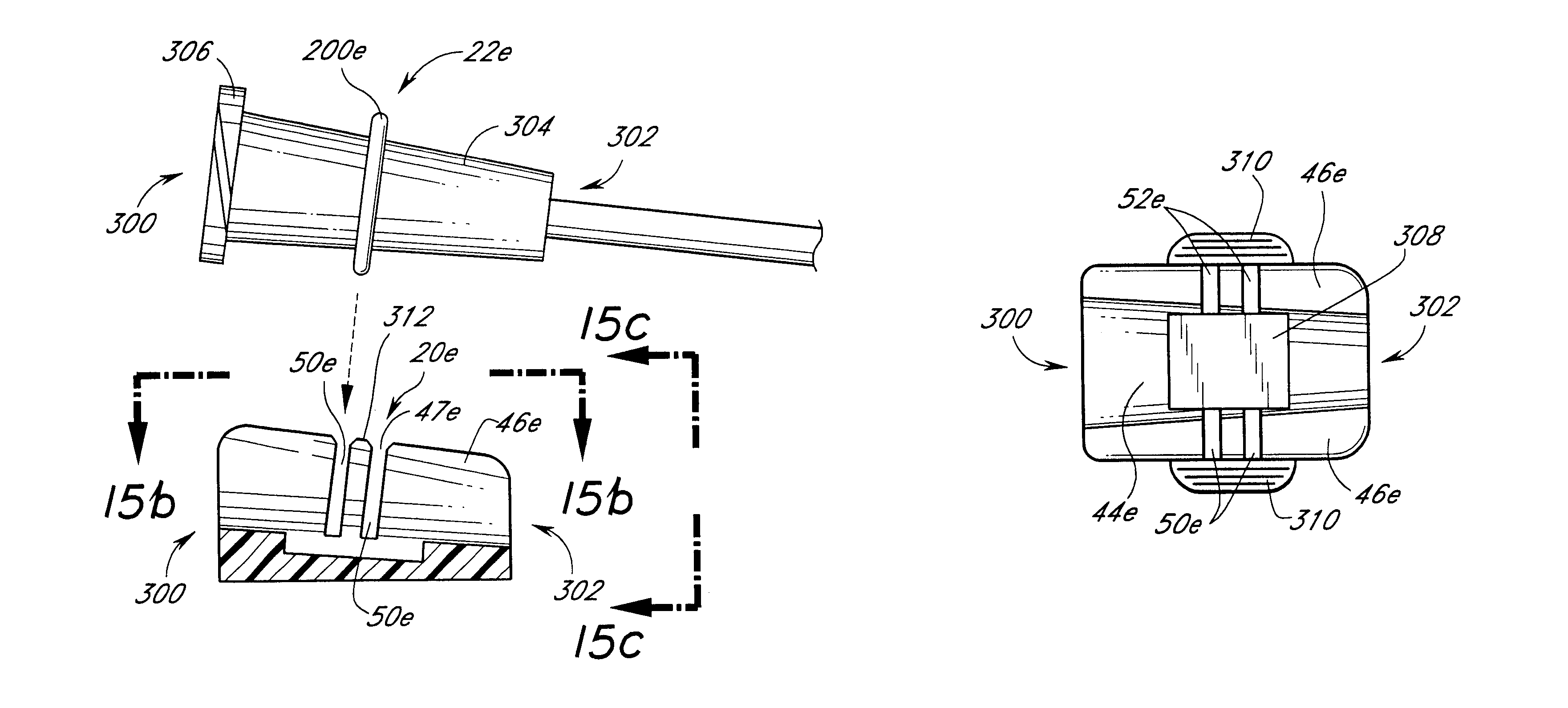 Catheter anchoring system