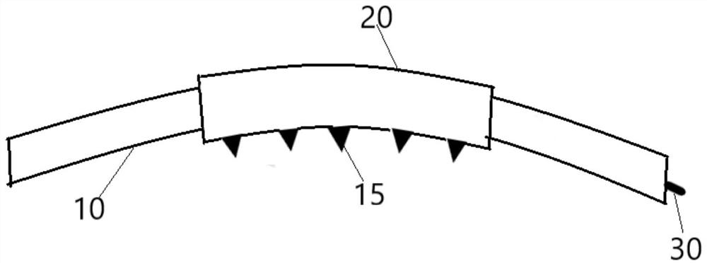 Schlemm canal dilatation stent and dilatation method